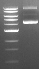 Image result for plasmid DNA gel